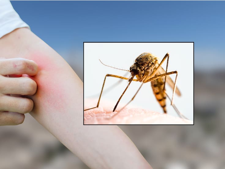 Casos de dengue en Sonora se cuadruplican en el periodo 2025-2026 y colocan al estado como líder nacional