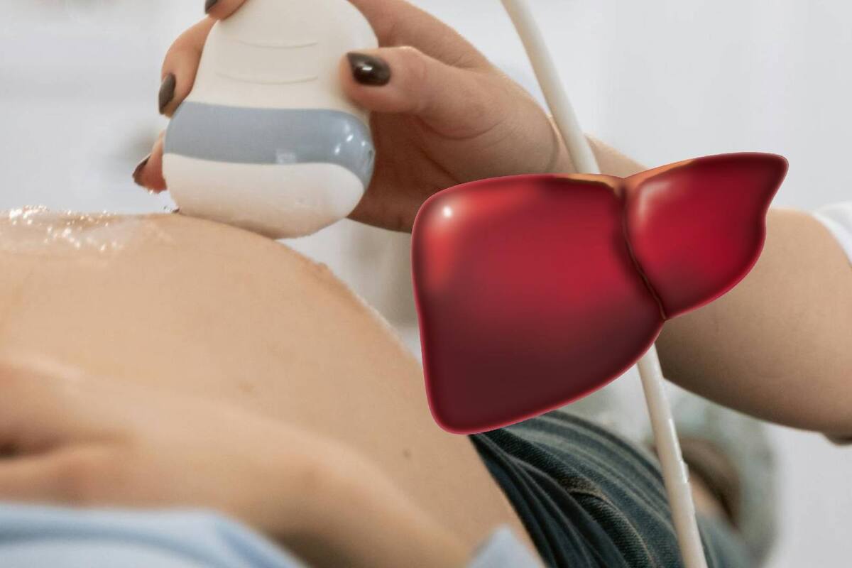 Azucena, la joven operada de embarazo ectópico alojado en el hígado; lo califican de un raro caso en la medicina