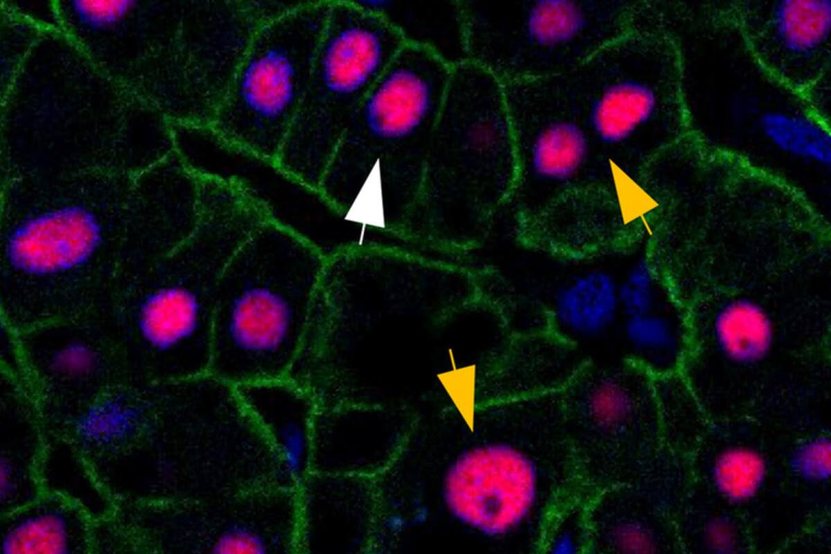 El hígado humano no envejece, siempre tiene la edad de tres años