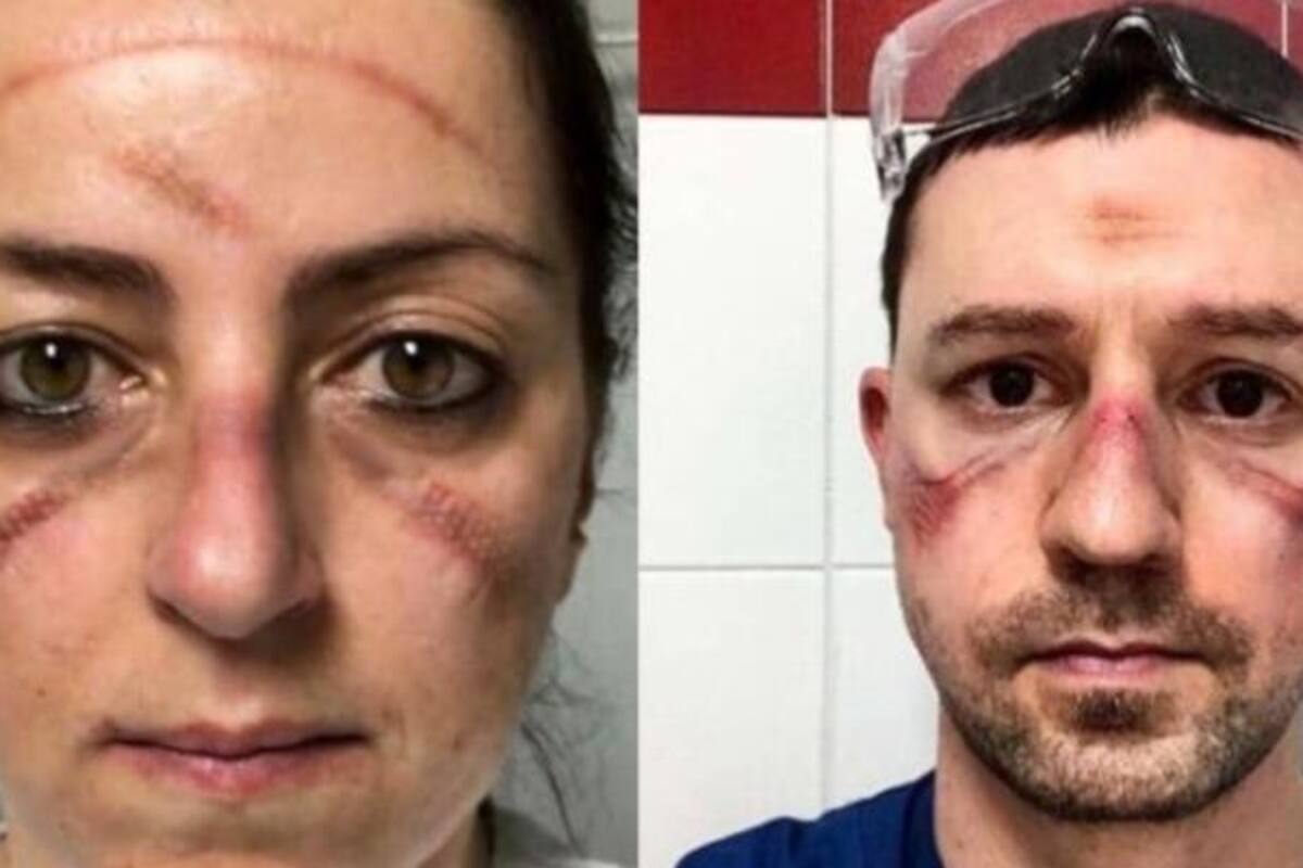 Así lucen los rostros de los médicos que luchan contra el Covid-19