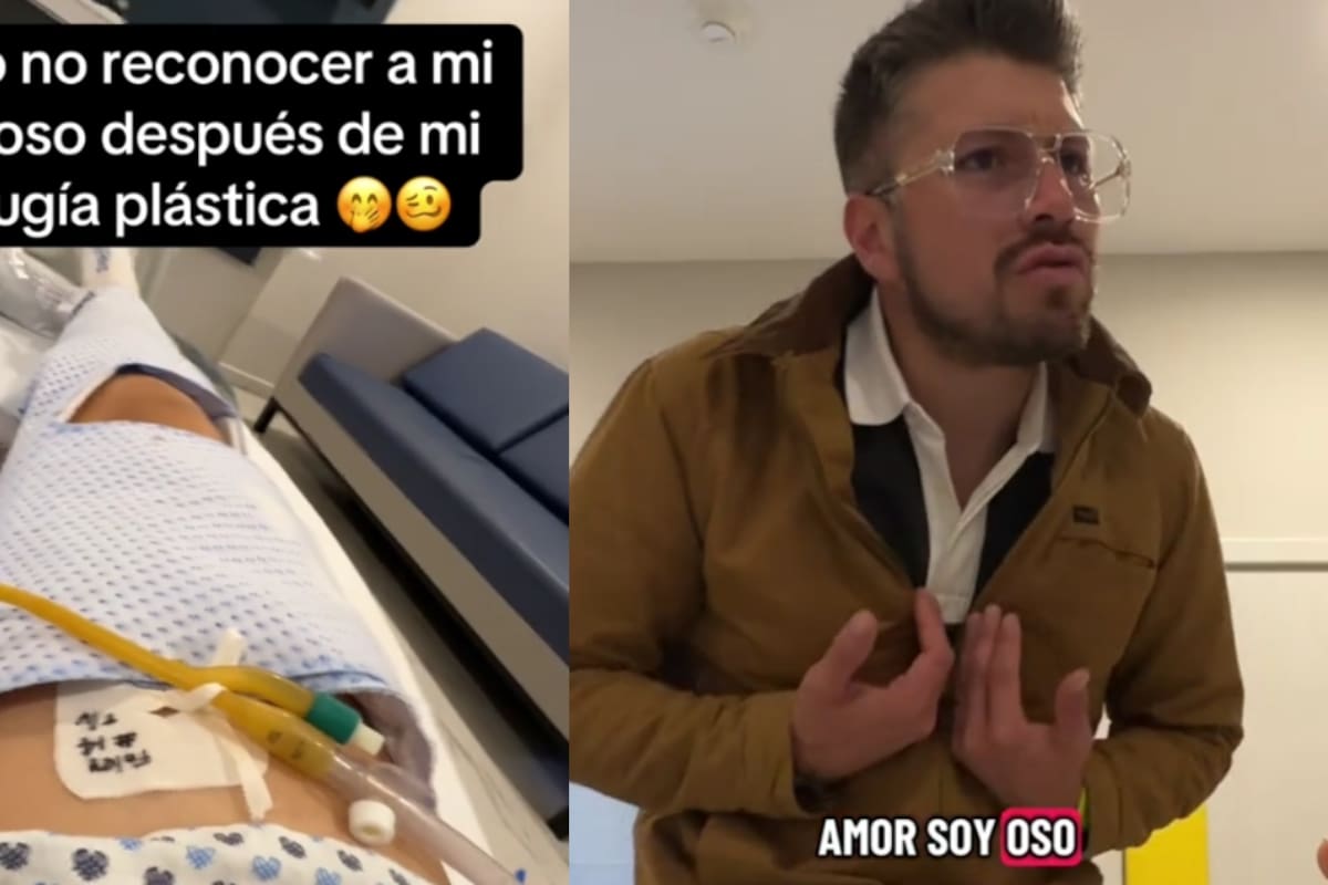 “¿Quién es usted? ¿Usted es el doctor?”: mujer finge no reconocer a su esposo tras una cirugía y su reacción se vuelve viral