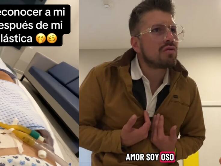 “¿Quién es usted? ¿Usted es el doctor?”: mujer finge no reconocer a su esposo tras una cirugía y su reacción se vuelve viral