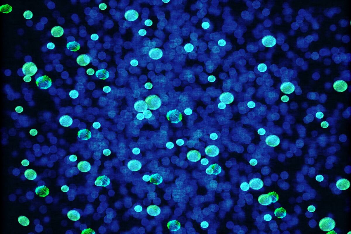 Uso de bacterias como sensores, la nueva tecnología que desarrolla EU para detectar bombas