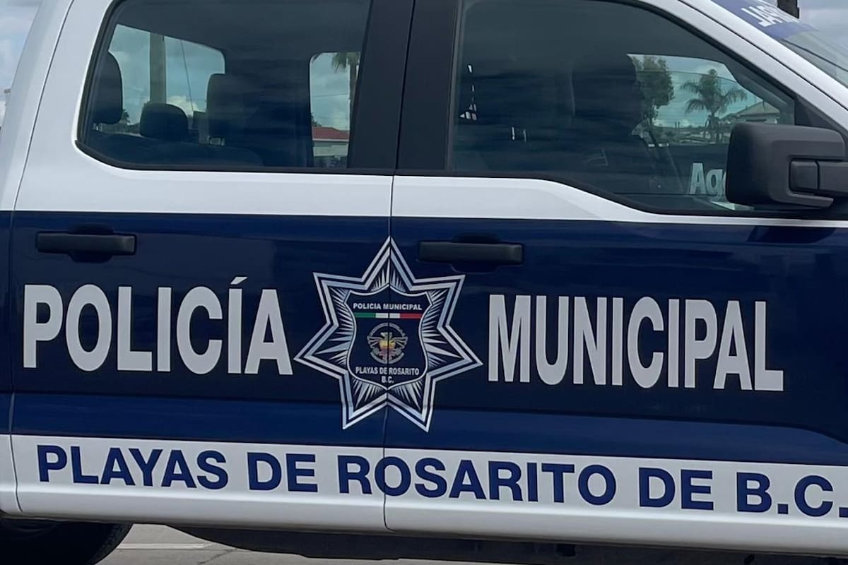 Mujer sufre fractura de brazo tras agresión de su esposo en caso de violencia familiar