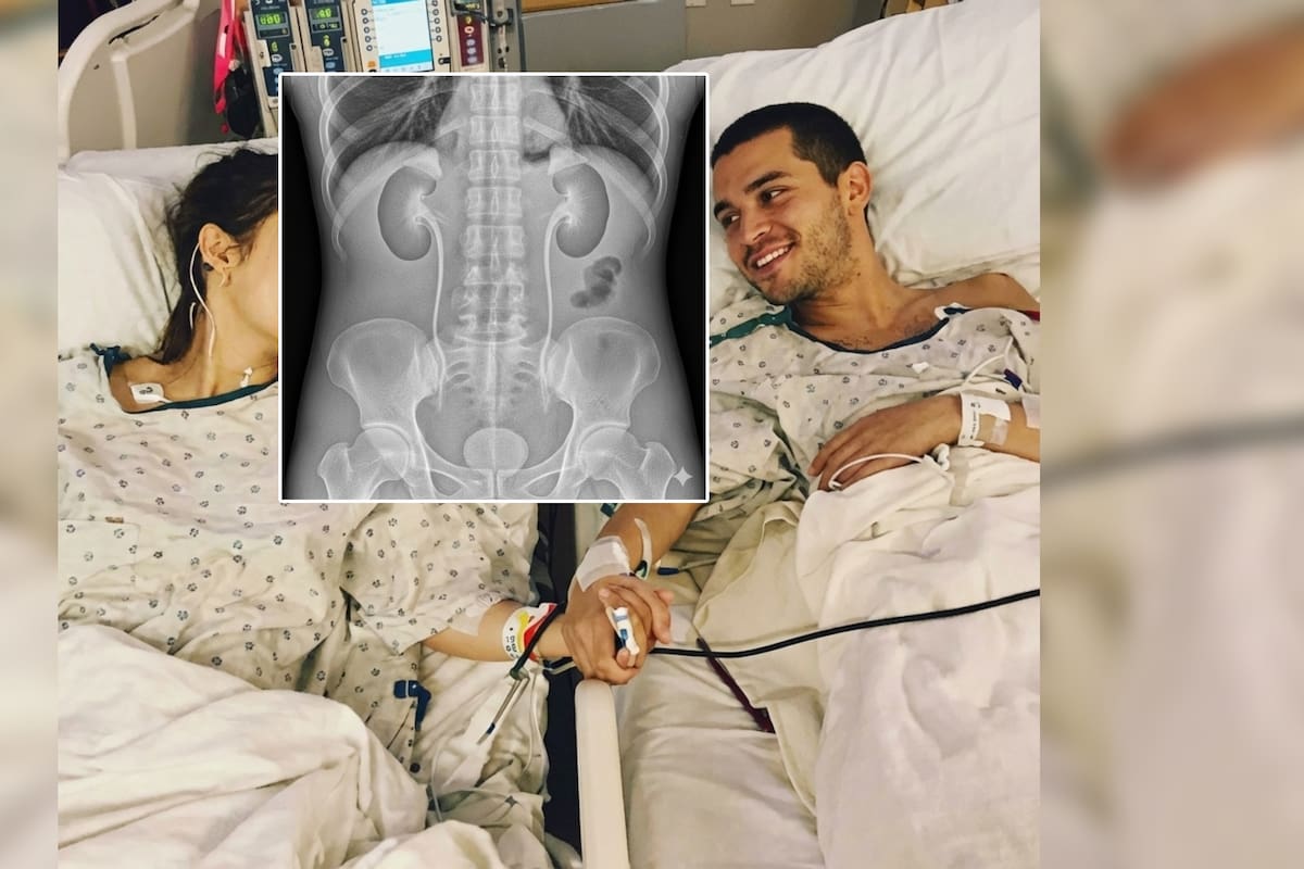 Joven le donó un riñón a su pareja y un mes después él se casó con la enfermera que lo atendió