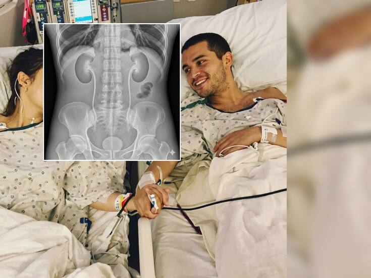 Joven le donó un riñón a su pareja y un mes después él se casó con la enfermera que lo atendió