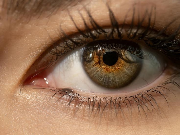 Síndrome del ojo seco: causas, síntomas y cuidados esenciales para proteger la vista