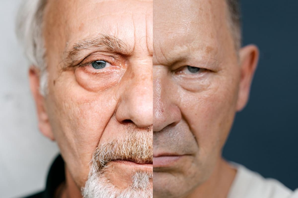 Cómo tratar el envejecimiento facial masculino de forma natural