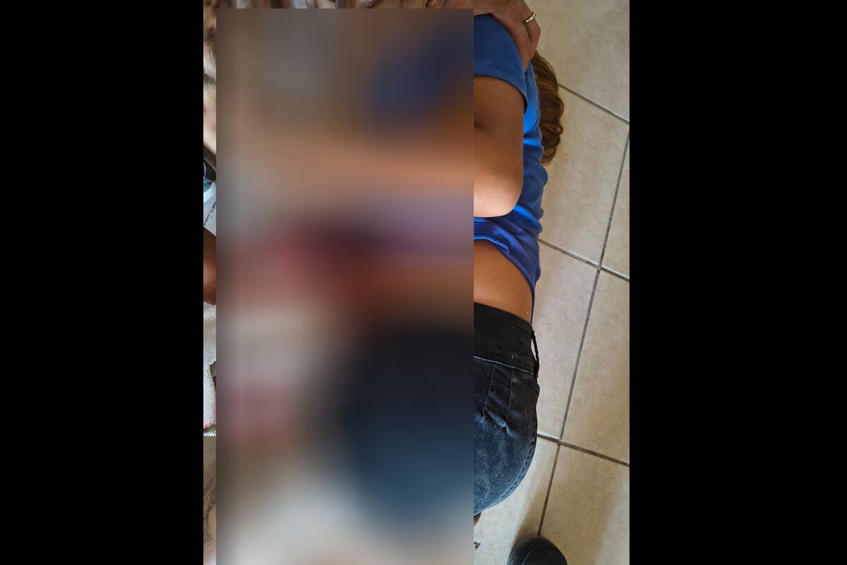 Mujer embarazada se dispara con arma larga en Villas de Alarcón