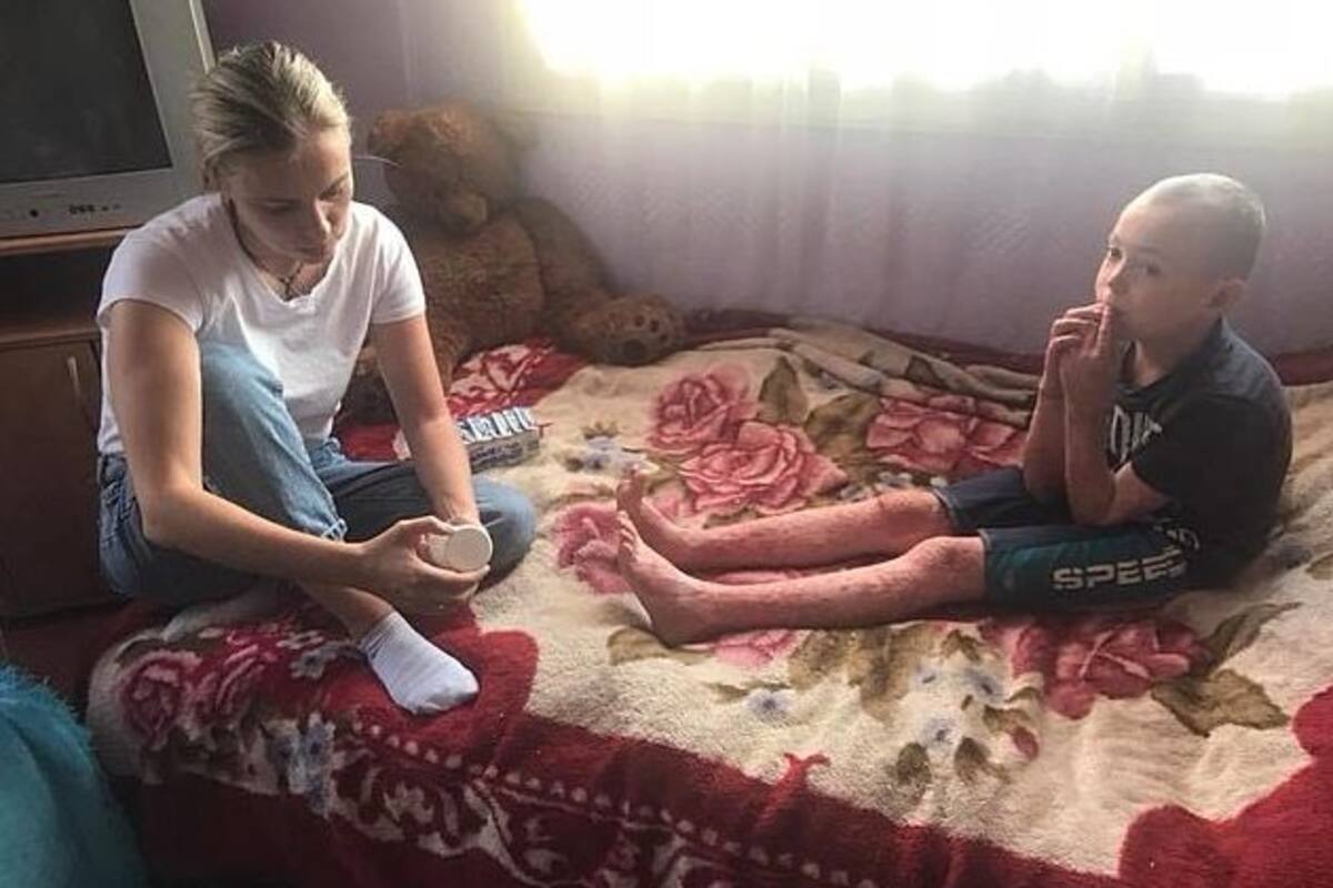 “Mamá, quiero morir”, dice niño que lucha contra la psoriasis