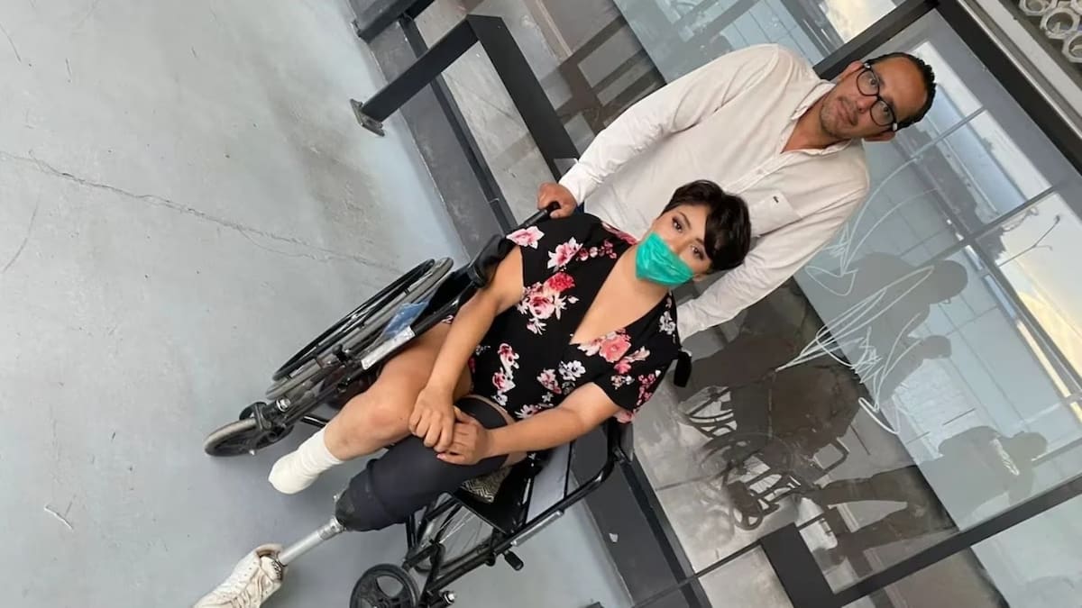 IMSS ofrece 88 mil pesos tras amputación y extirpación de órganos por negligencia médica; una prótesis cuesta hasta 150 mil. Foto: Heraldo de México