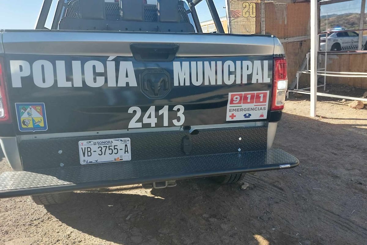 Recibe balazo en la cabeza joven de Nogales