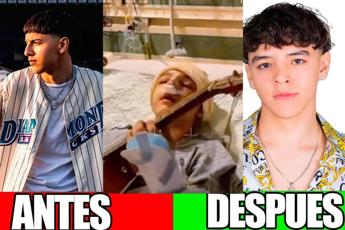 Xavi y el accidente que le cambió su rostro y la vida, antes de "La Diabla" y "La Víctima"