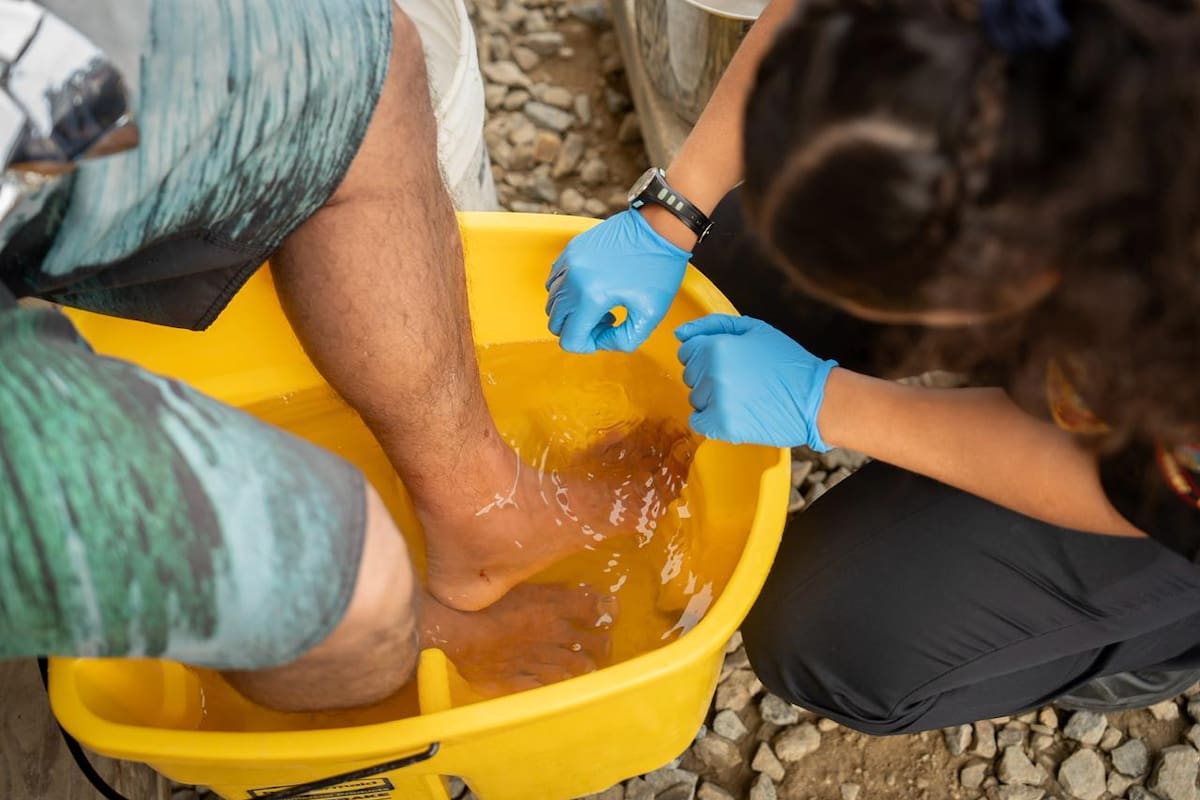Picadura de mantarraya deja lesionado a pescador en Playas de Tijuana
