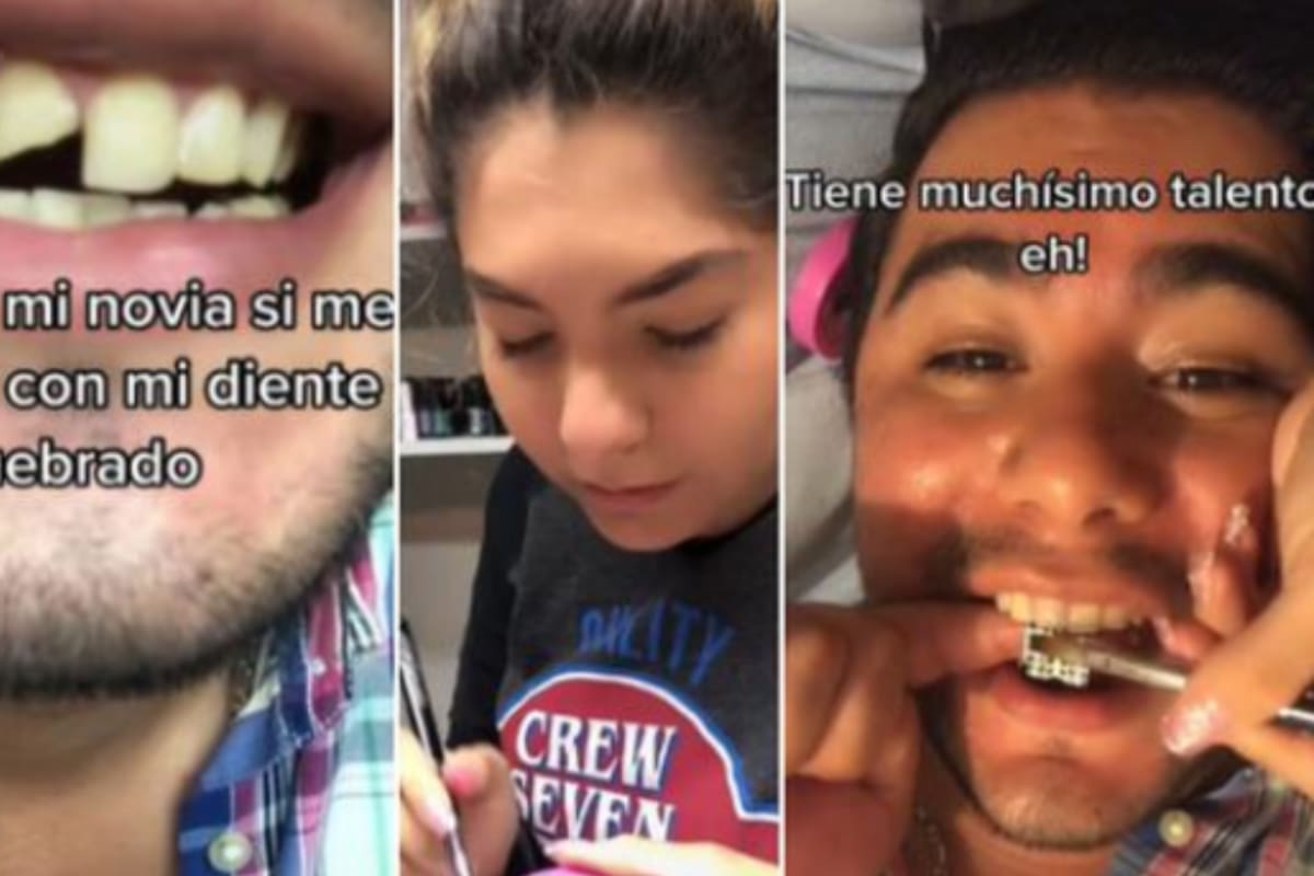 TikTok: Se le quebró un diente y su novia manicurista se lo ‘arregló’ con una uña