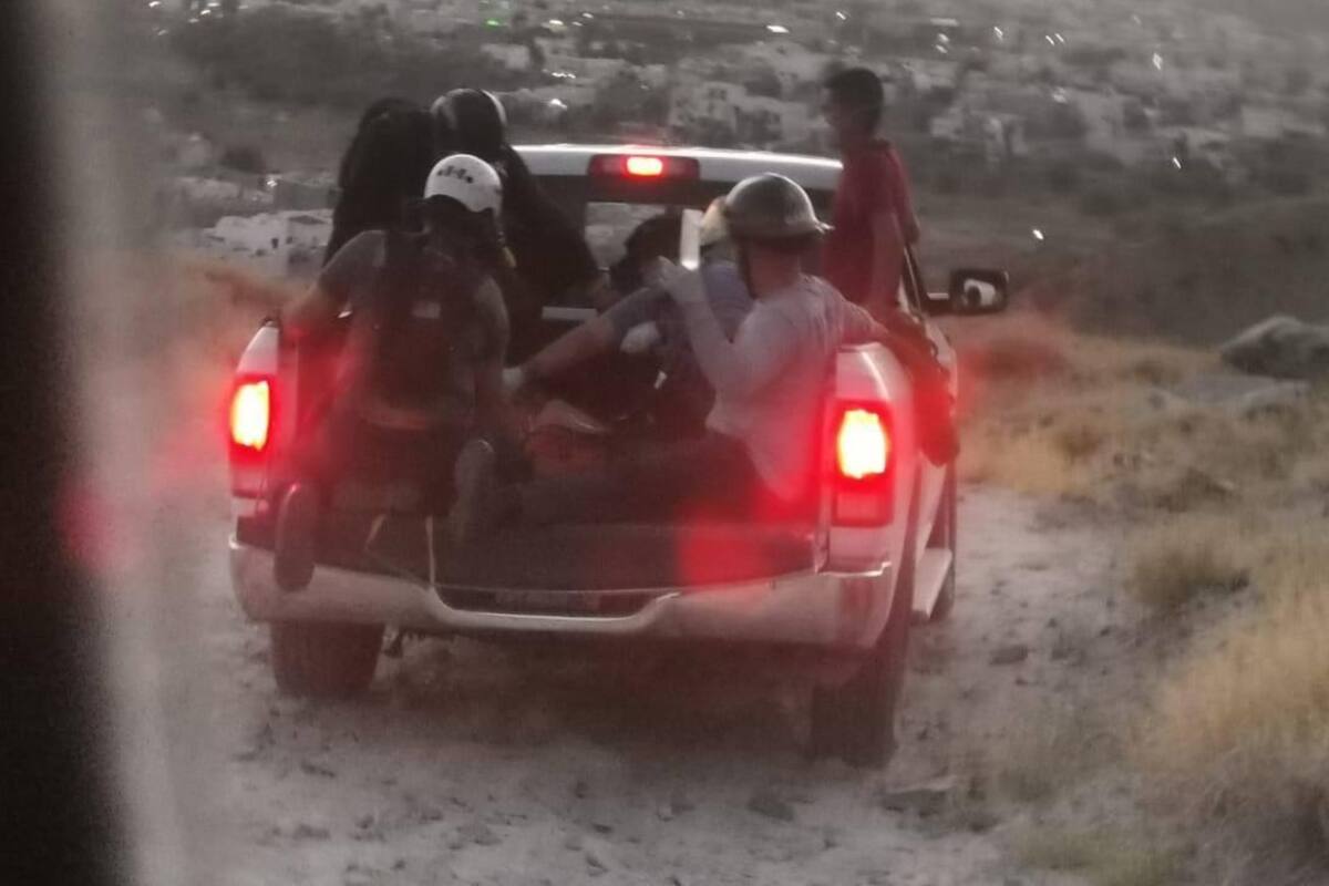 Joven sufre quemaduras de tercer grado cerca del Cerro del Bachoco