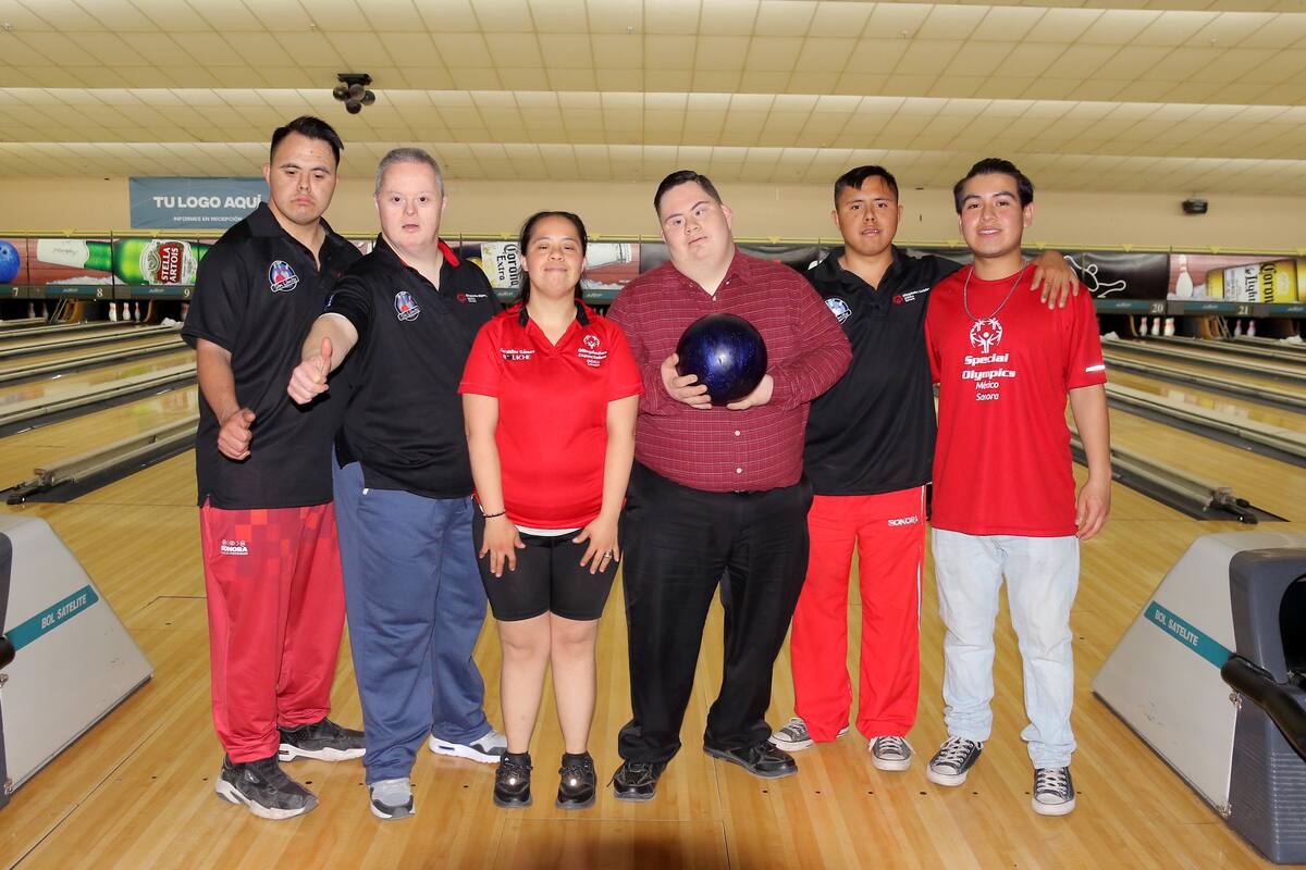 ¿Cómo es nacer con Síndrome de Down realmente fuera mitos y estigmas?