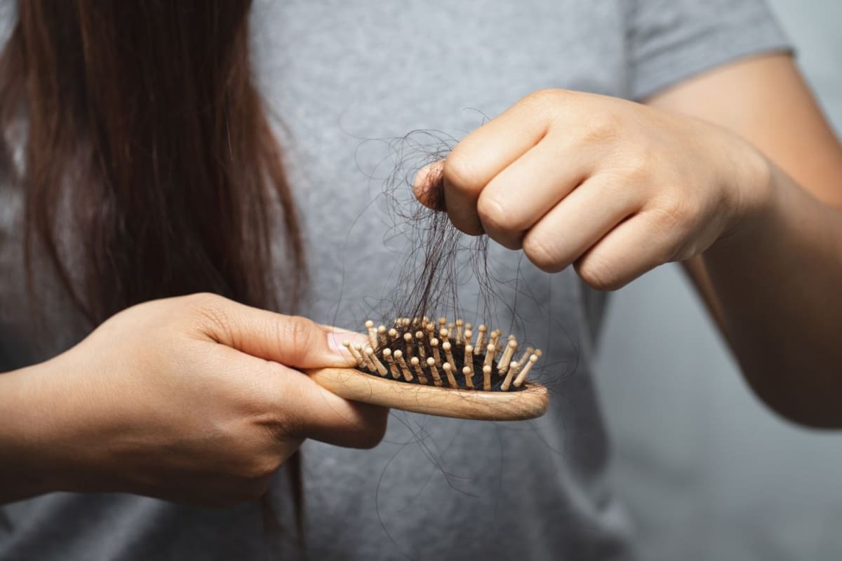 Expertos alertan que la caída del cabello puede revelar hasta 10 problemas de salud distintos y advierten cuándo la pérdida capilar deja de ser normal