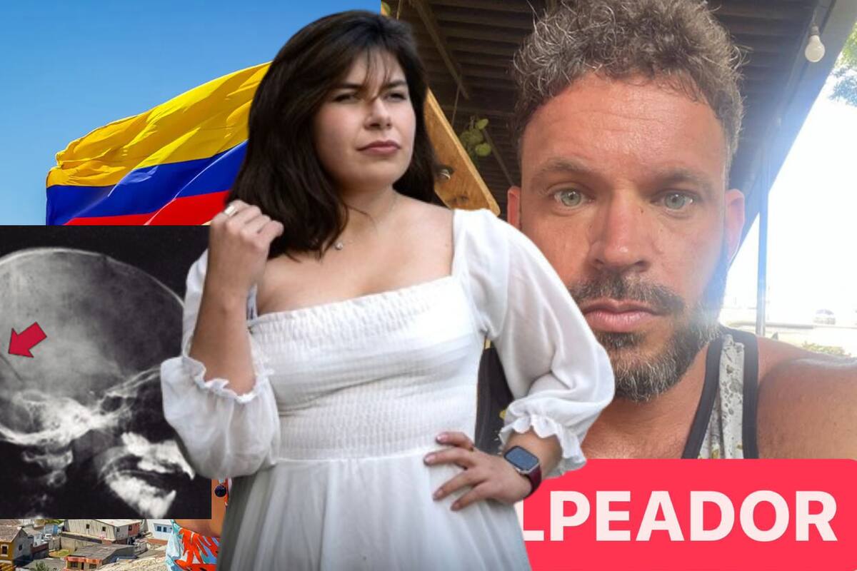 Mexicana escapa con cráneo herido de vacaciones en Colombia por violencia de su ex pareja