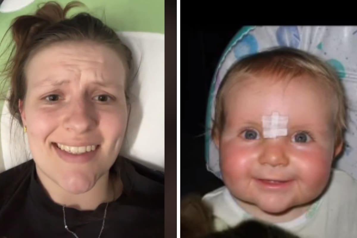 TikTok: Mujer se entera que “devoró” a su propia hermana gemela cuando era un feto