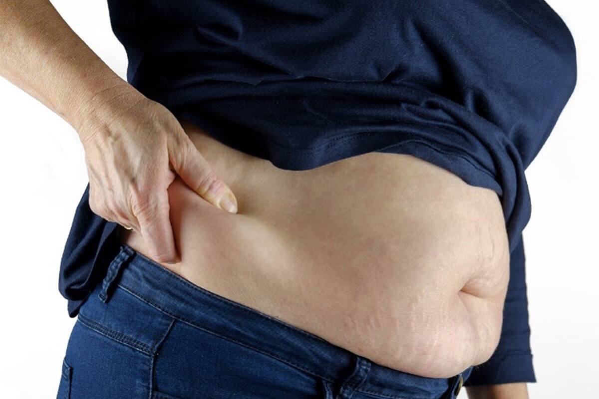 México: El cuarto país con mayor obesidad en América
