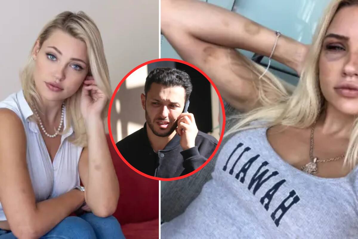 Cirujano acusado de hacer ‘esclava sexual’ a modelo; además golpeó e inyectó hormonas a su exesposa, según demanda