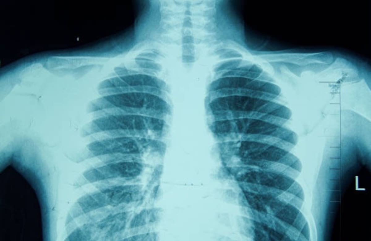 Foto: istock