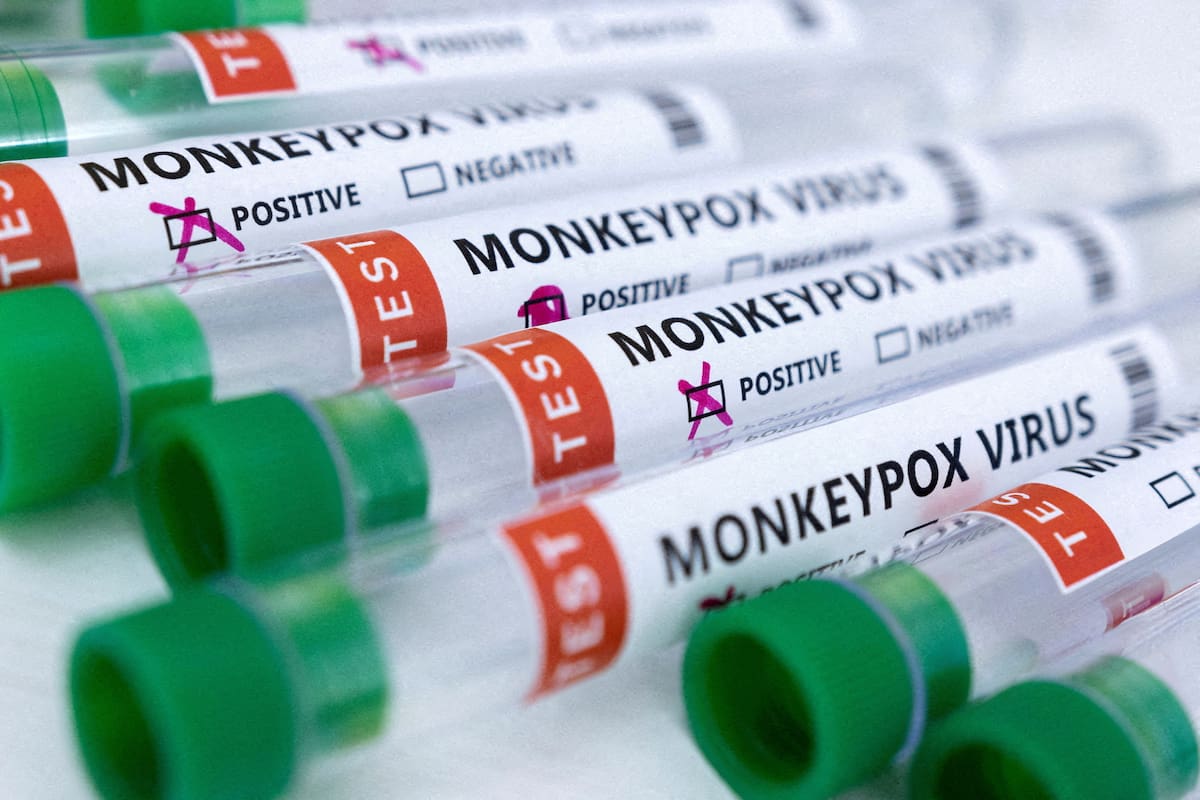 OMS plantea posible “emergencia internacional” por aumento de casos de viruela del mono