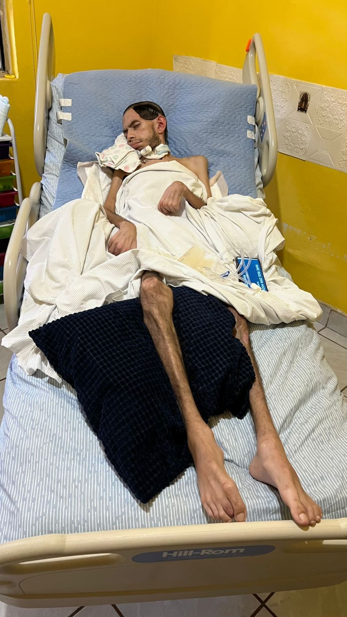 Su mamá busca una operación para que le coloque en una placa en la cabeza.
Foto: Cortesía