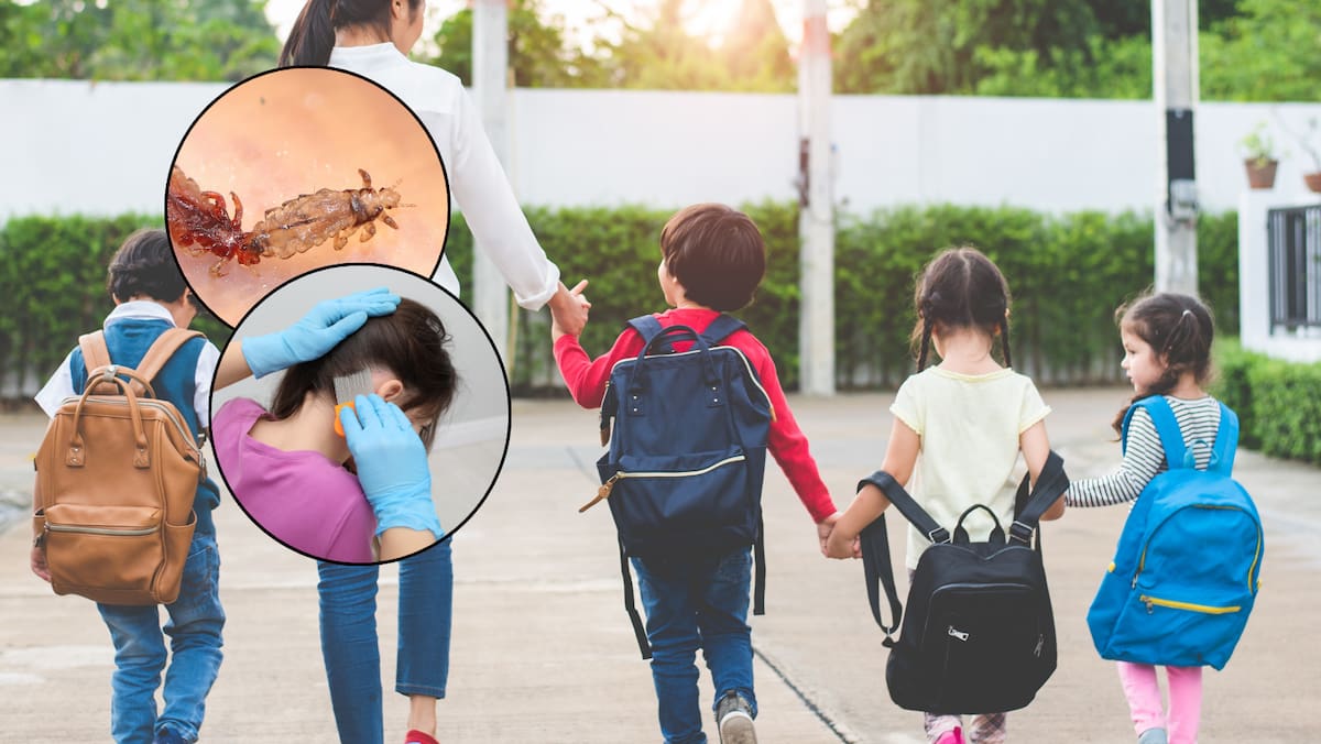 Consejos de pediatra: prevenir piojos en el regreso a clases