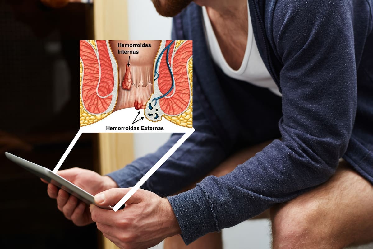 Usar el celular en el baño podría provocarte hemorroides por esta sencilla razón