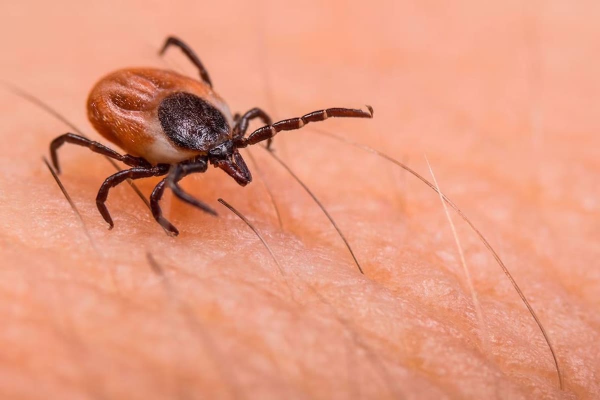 Tijuana suma nueve muertes por rickettsia en 2024