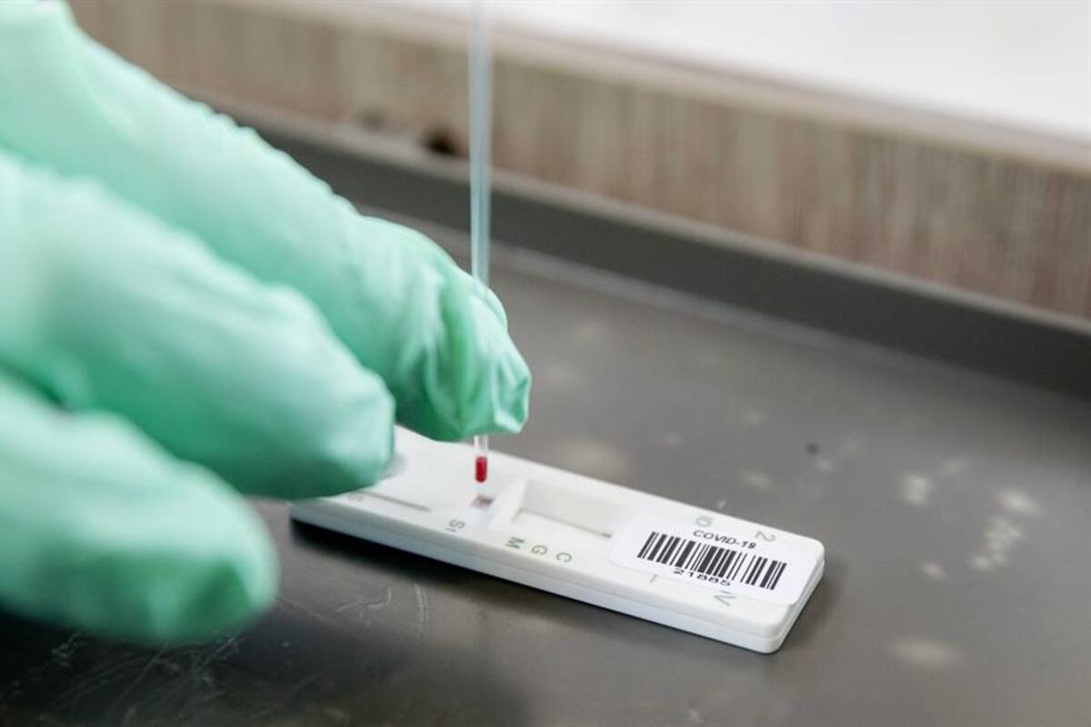 UNAM desarrolla prueba rápida y de bajo costo para detectar Covid-19