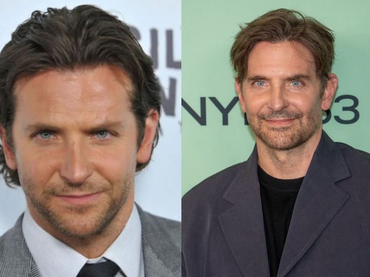 Rellenos, Facelift y Blefaroplastia: Los Procedimientos que Atribuyen a Bradley Cooper tras su Nuevo Rostro