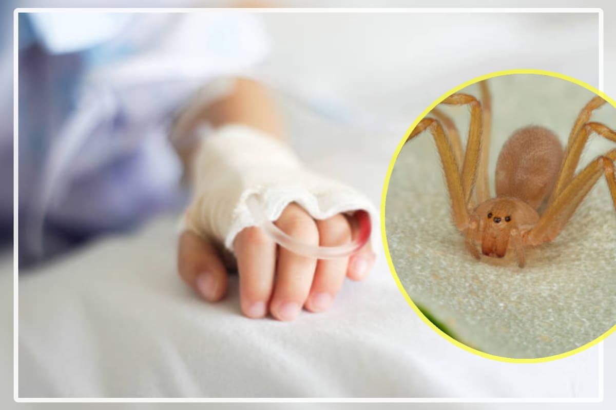 Niño “murió” cuatro veces tras ser picado por araña violinista: ¿Qué pasó?