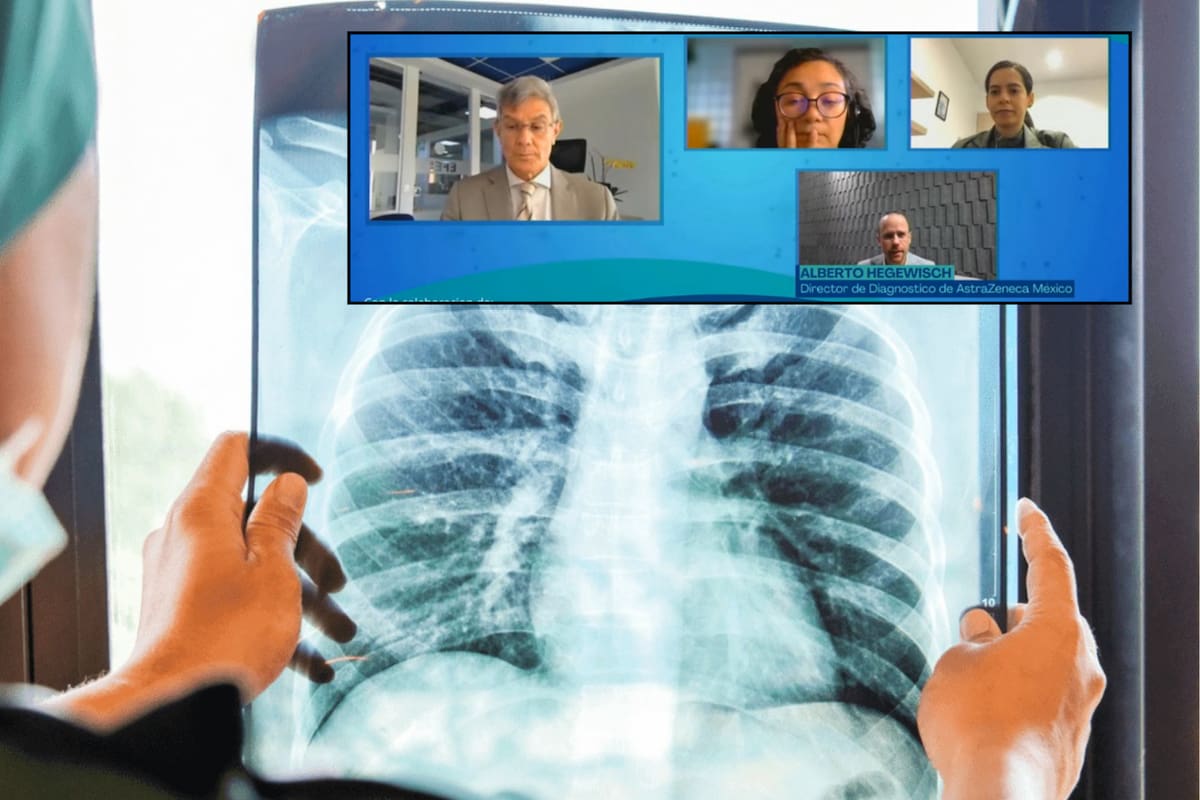 La inteligencia artificial podría ser clave en el futuro del diagnóstico del cáncer de pulmón en América Latina, afirman especialistas