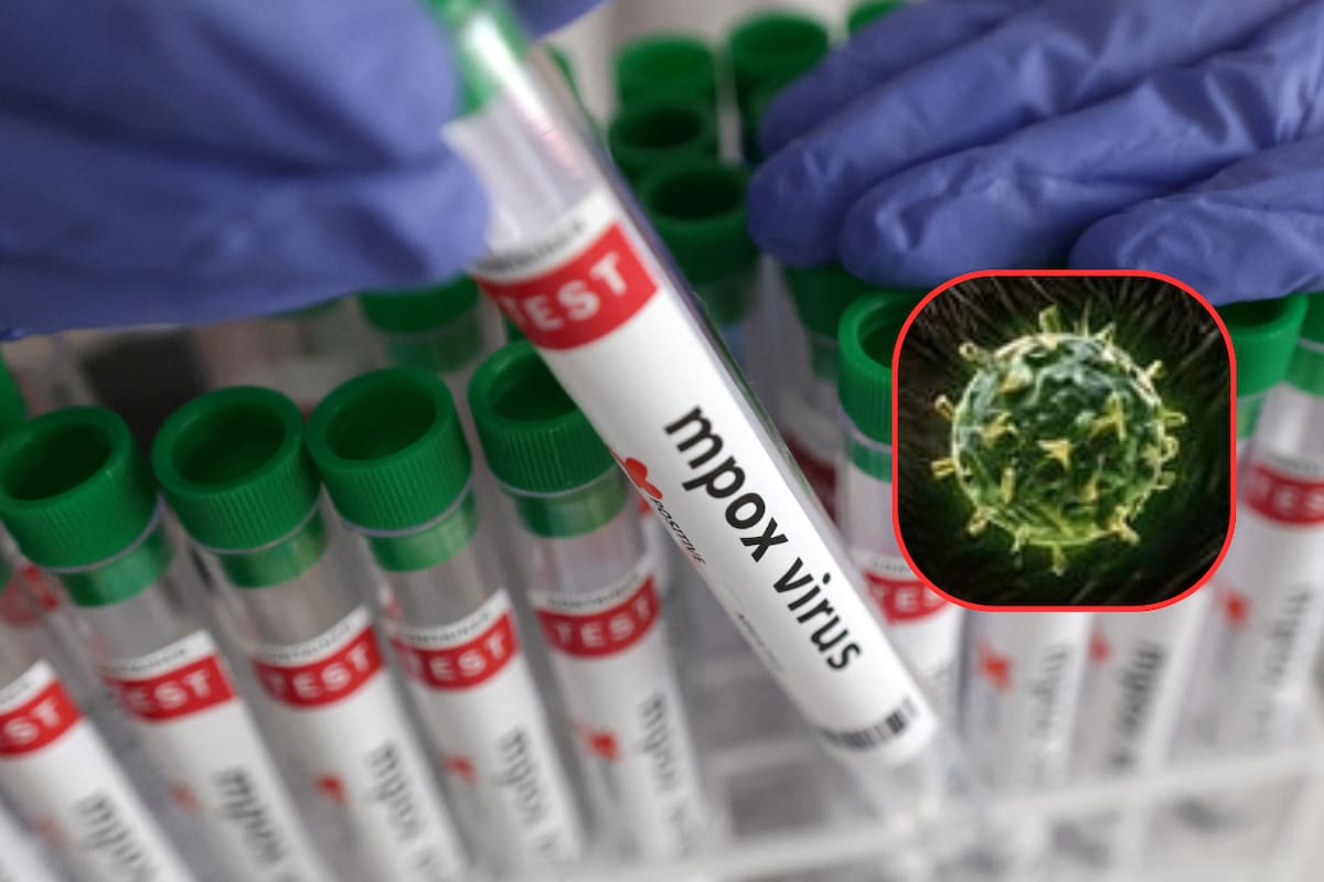 China detecta un nuevo clado de la viruela símica mientras la enfermedad se extiende internacionalmente