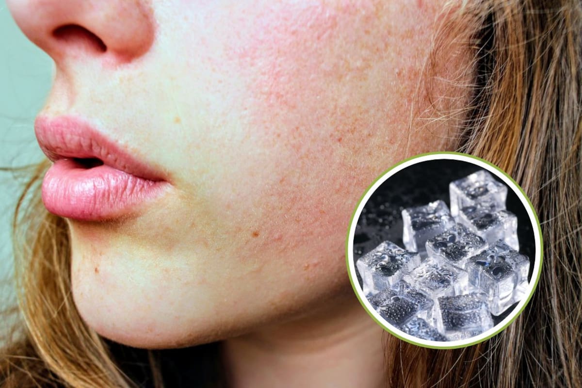 Cómo usar cubitos de hielo para desinflamar el rostro y cerrar poros