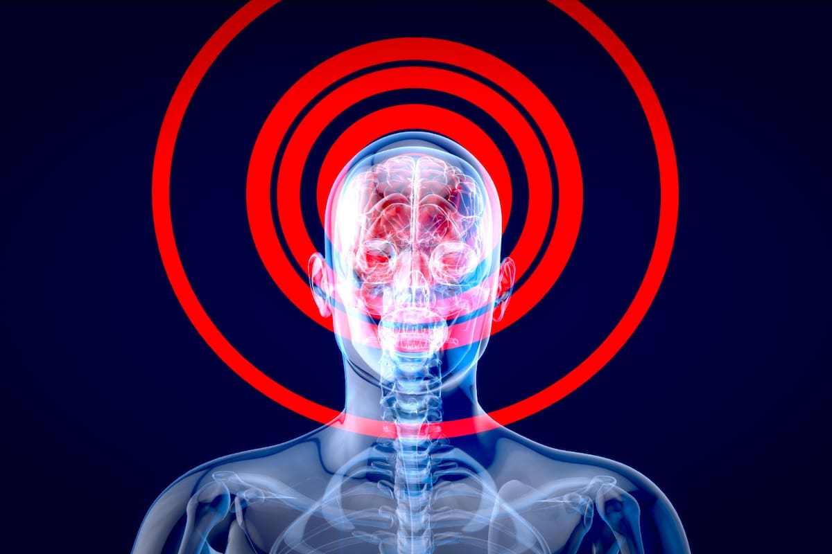 Qué pasa en el cerebro cuando una persona no duerme: hallazgos de un nuevo estudio