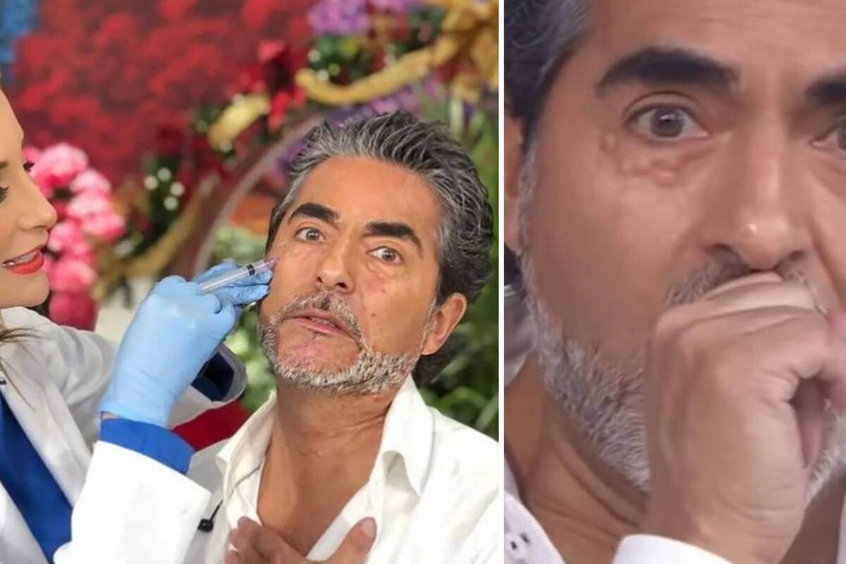 ¿Reacción alérgica?: Raúl Araiza se somete a tratamiento estético en 'Hoy'