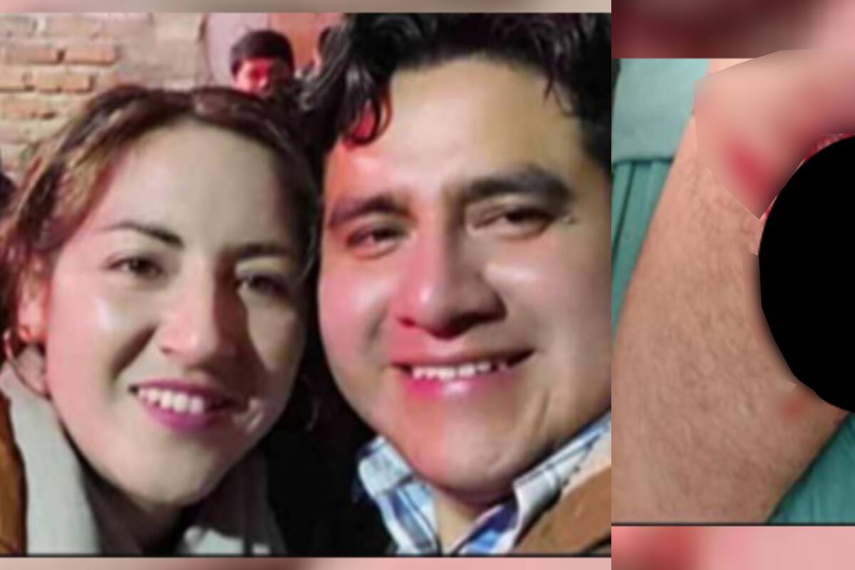 Mujer corta miembro de su esposo a horas de San Valentín por aparentes celos
