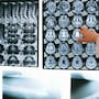 Investigadores en Barcelona confirman que combinar un fármaco trombolítico con la trombectomía mejora la evolución del ictus grave, un hallazgo que podría cambiar los tratamientos actuales al aumentar la recuperación de los pacientes a los 90 días