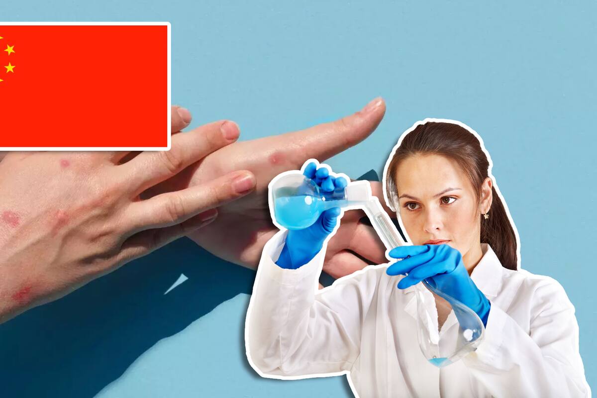Mpox: China aprueba su primer test para detectar esta enfermedad