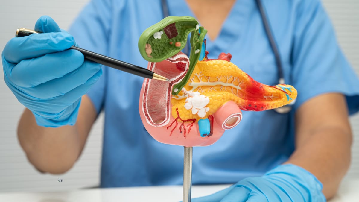 Terapia experimental logra frenar el cáncer de páncreas antes del tumor y triplica la supervivencia en ratones, abriendo la puerta a detectarlo a tiempo