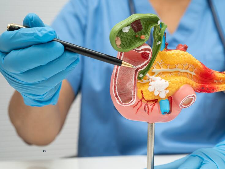 Terapia experimental logra frenar el cáncer de páncreas antes del tumor y triplica la supervivencia en ratones, abriendo la puerta a detectarlo a tiempo