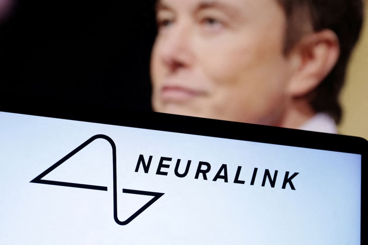 Volver a ver con una alta resolución con el tiempo, apuesta Neuralink, el proyecto fundado por Elon Musk y que reveló que ya hay más de 20 personas con implantes cerebrales en el mundo como parte de ensayos de prueba