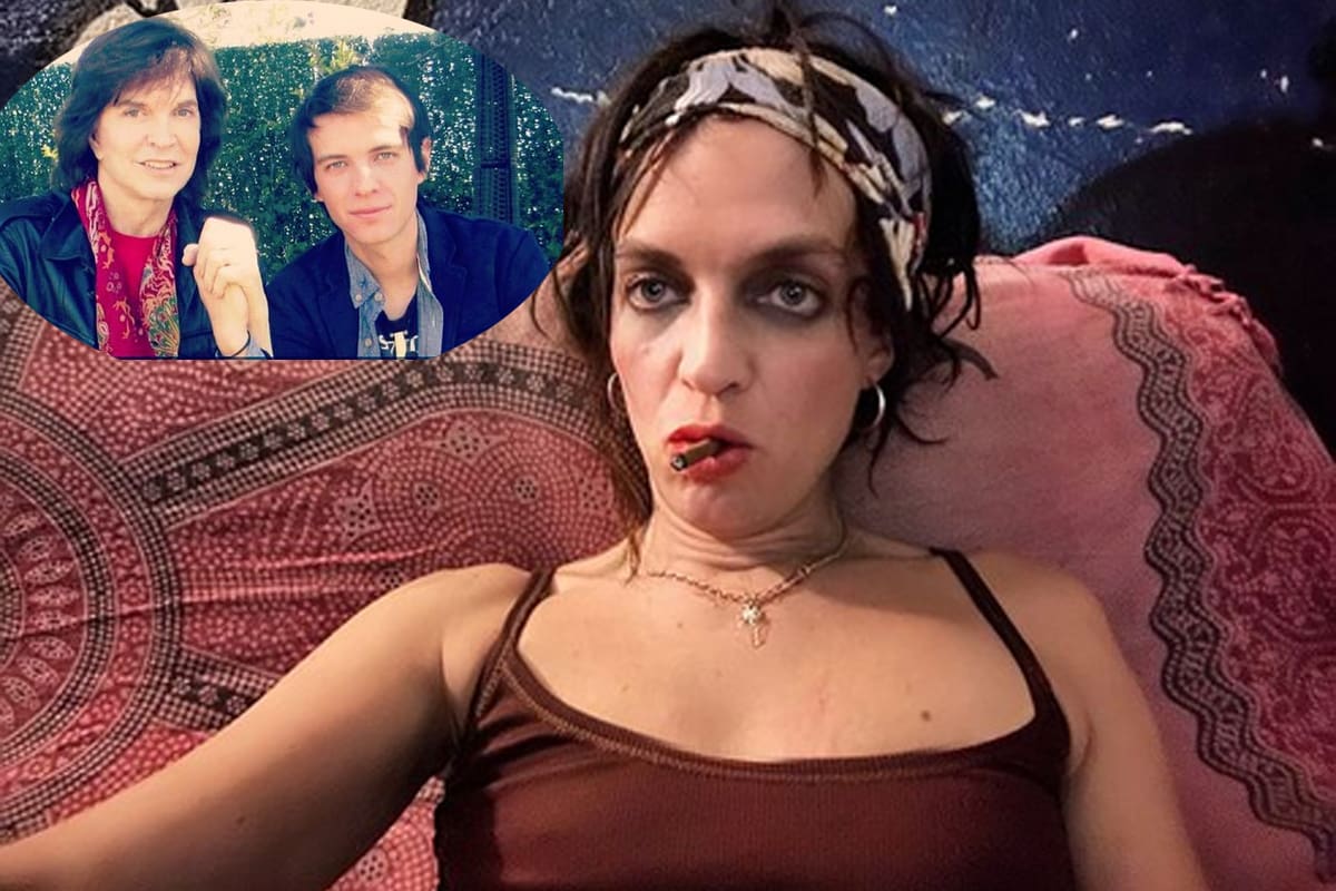 Fans de Camilo Blanes se alertan por heridas en sus piernas