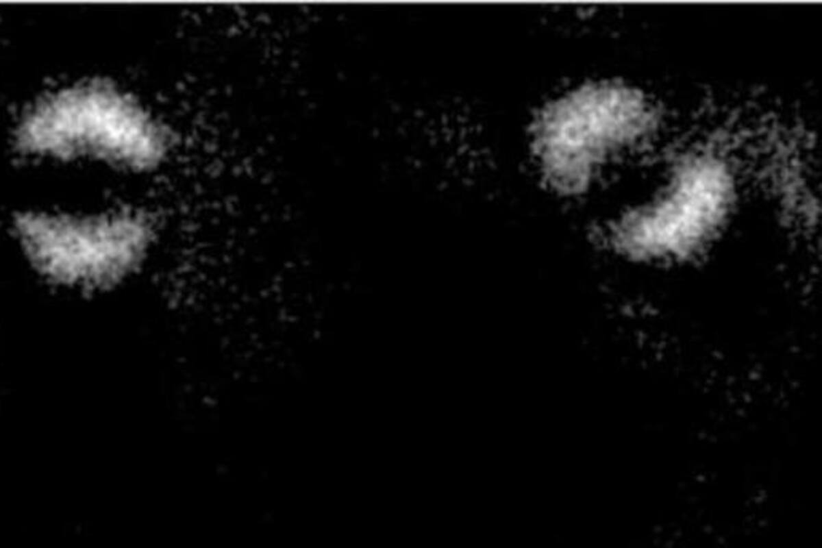 Obtienen la primera imagen del 'entrelazamiento cuántico' de Einstein