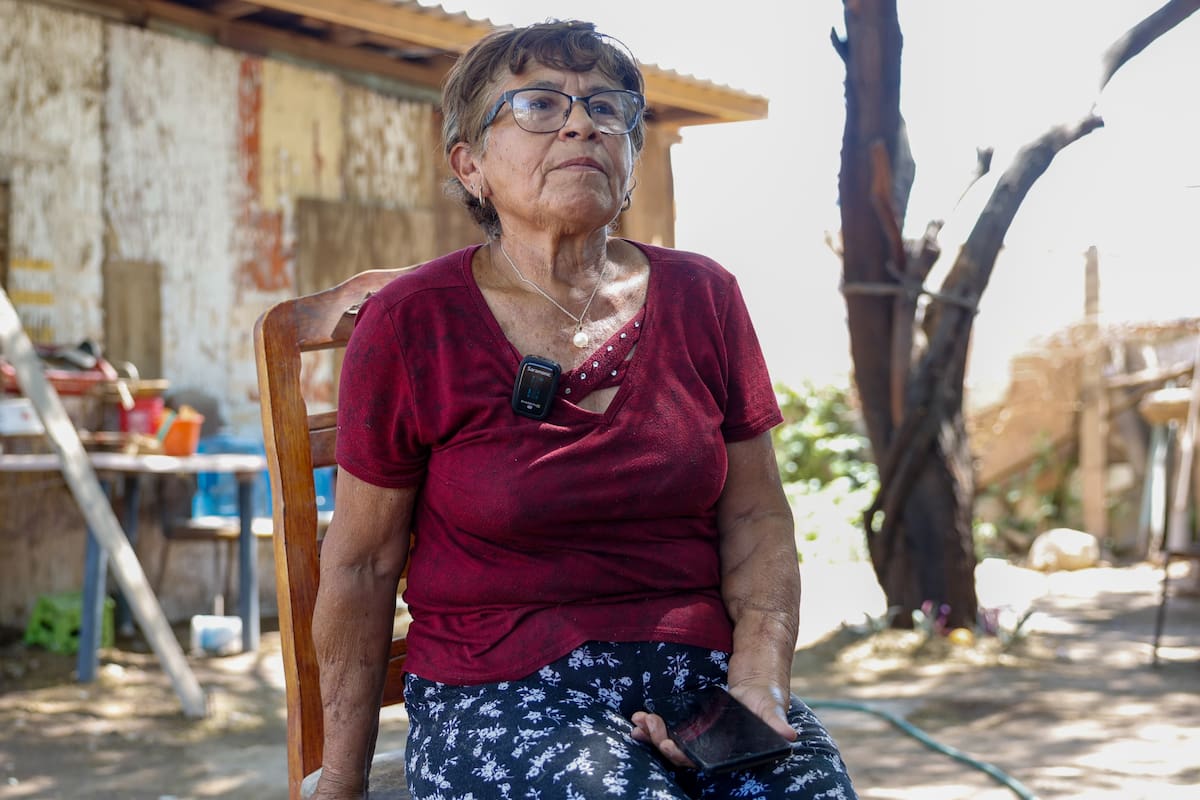 El ataque de cinco perros cambió la vida de Georgina Reyes Estrada