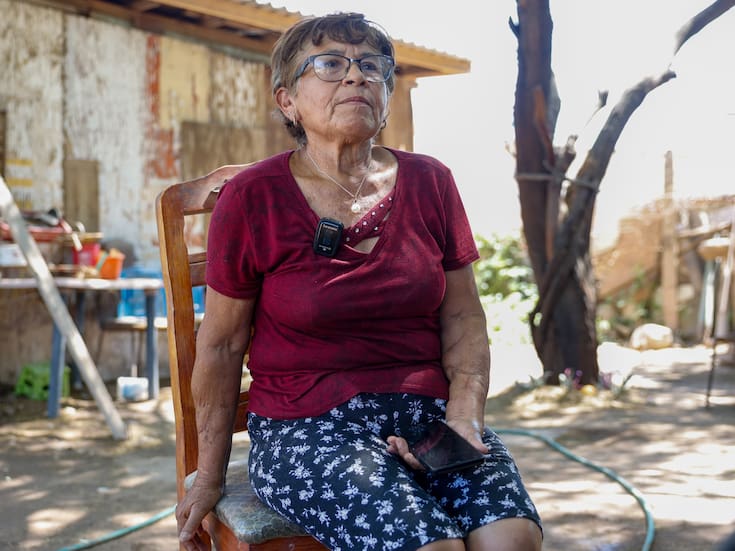 El ataque de cinco perros cambió la vida de Georgina Reyes Estrada